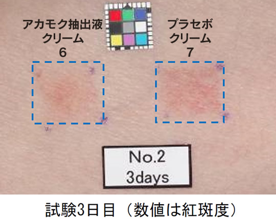 アカモク抽出液配合製剤で、紫外線照射による紅斑抑制の画像