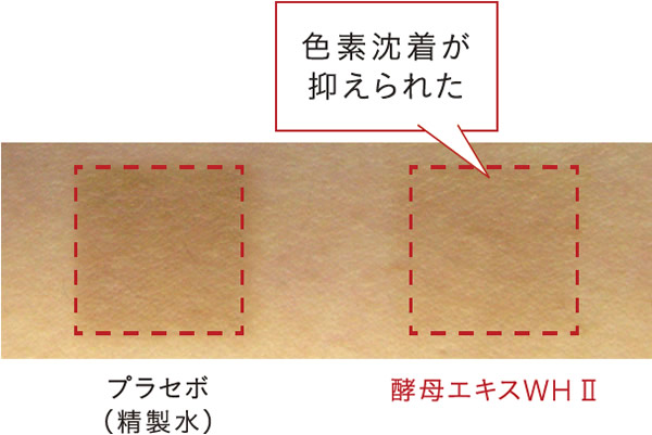 酵母エキスWHⅡの色素沈着抑制作用。ヒト皮膚にて、色素沈着抑制の効果が見られた。