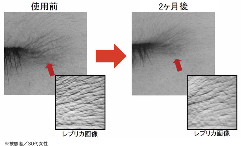 セラムバイタル配合製剤を用いたヒト試験の図。目尻のシワが浅くなる効果が見られた。