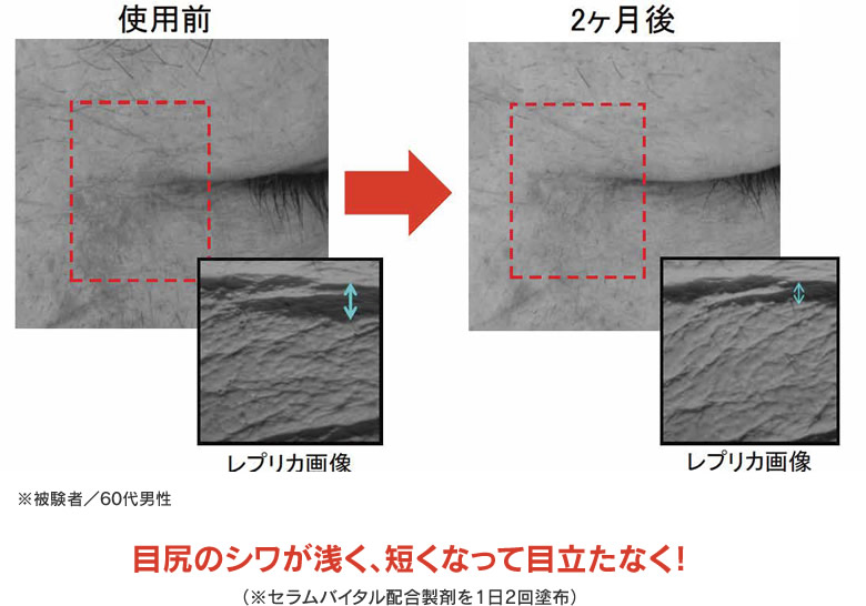 セラムバイタル配合製剤を用いたヒト試験の図。目尻のシワが浅くなる効果が見られた。