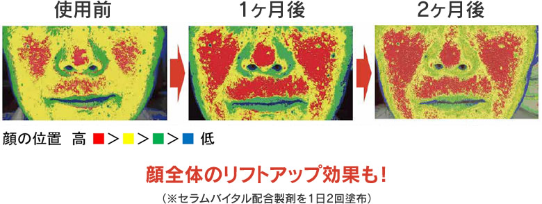 セラムバイタル配合製剤のヒト試験の結果。顔全体のリフトアップ効果が確認された。