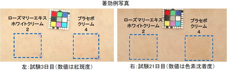 ローズマリーエキスホワイトのヒト試験の結果。色素沈着抑制効果が確認された。