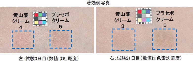 黄山薬抽出液のヒト試験の結果。紫外線照射による紅斑抑制、色素沈着抑制効果が見られた。