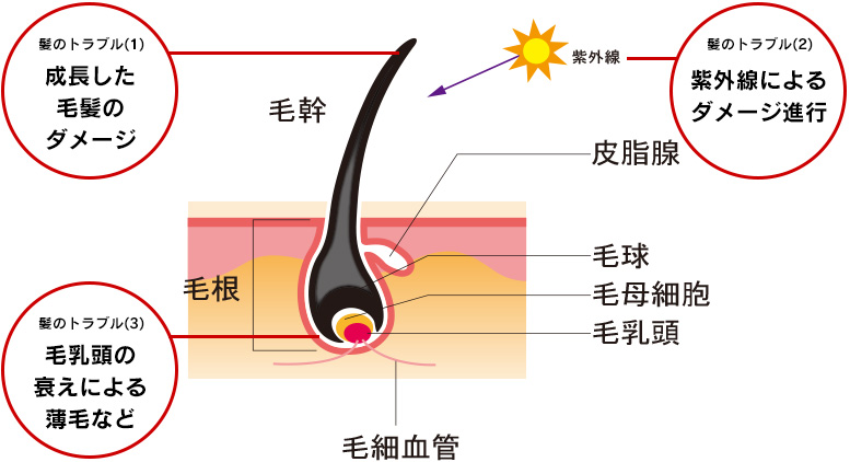 髪のトラブルのイメージ図