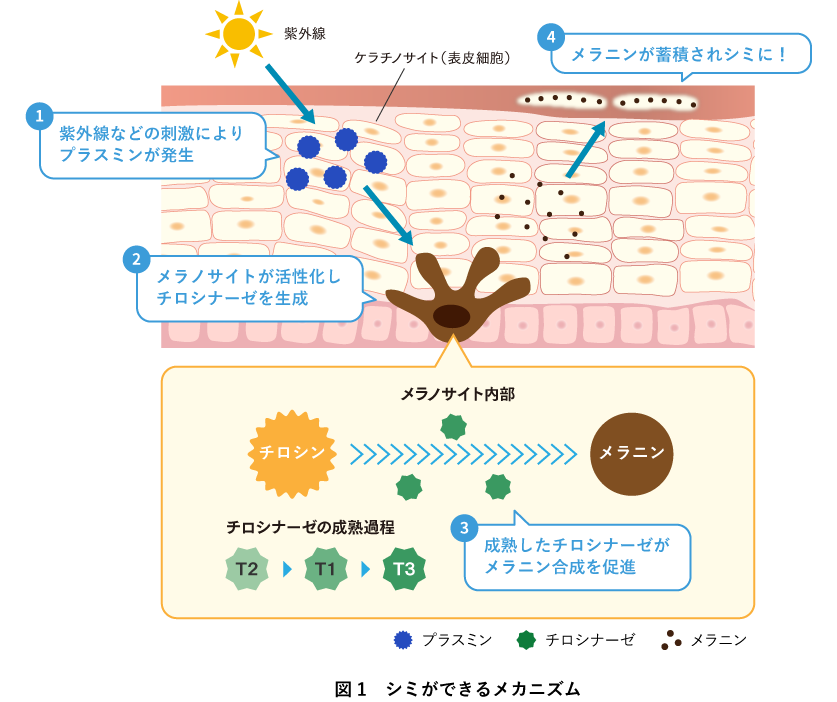 シミができるメカニズム