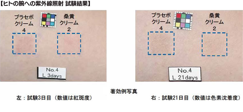 桑黄抽出液配合クリームを用いたヒト試験。紅斑抑制効果、色素沈着抑制効果がみられた。