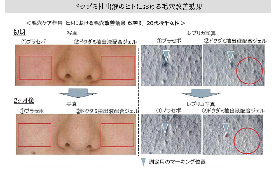 ドクダミ抽出液のヒトにおける毛穴改善効果