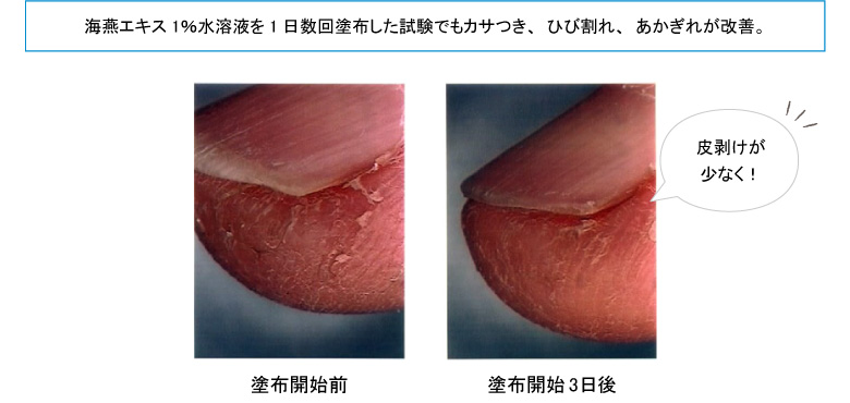 海燕エキス配合クリームのヒト試験結果